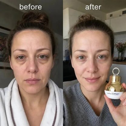 SADOER Collagen Firming Massage Eye Cream LED masszázsfejjel – 30 g - BELADY
